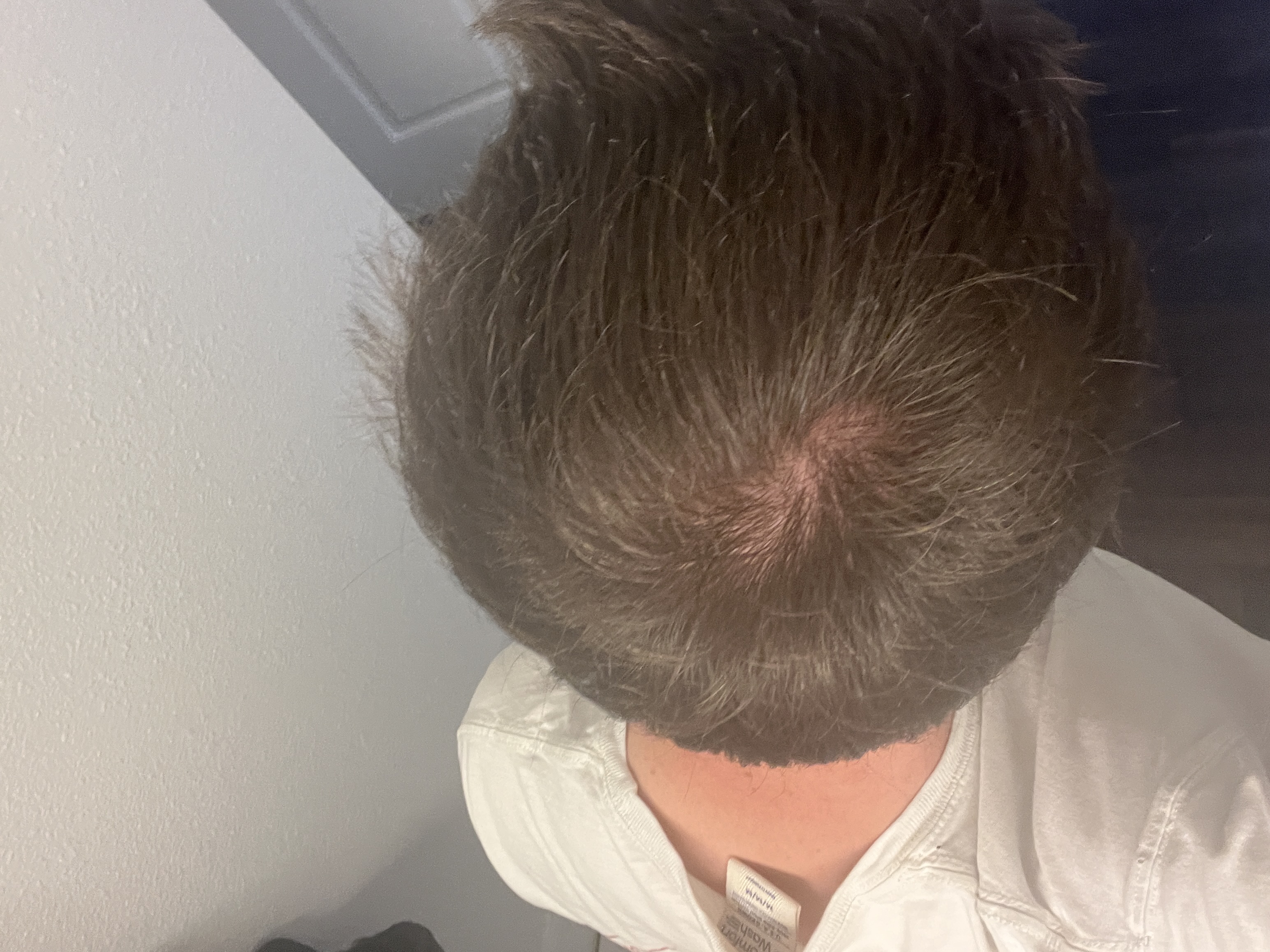 Crown after treatment