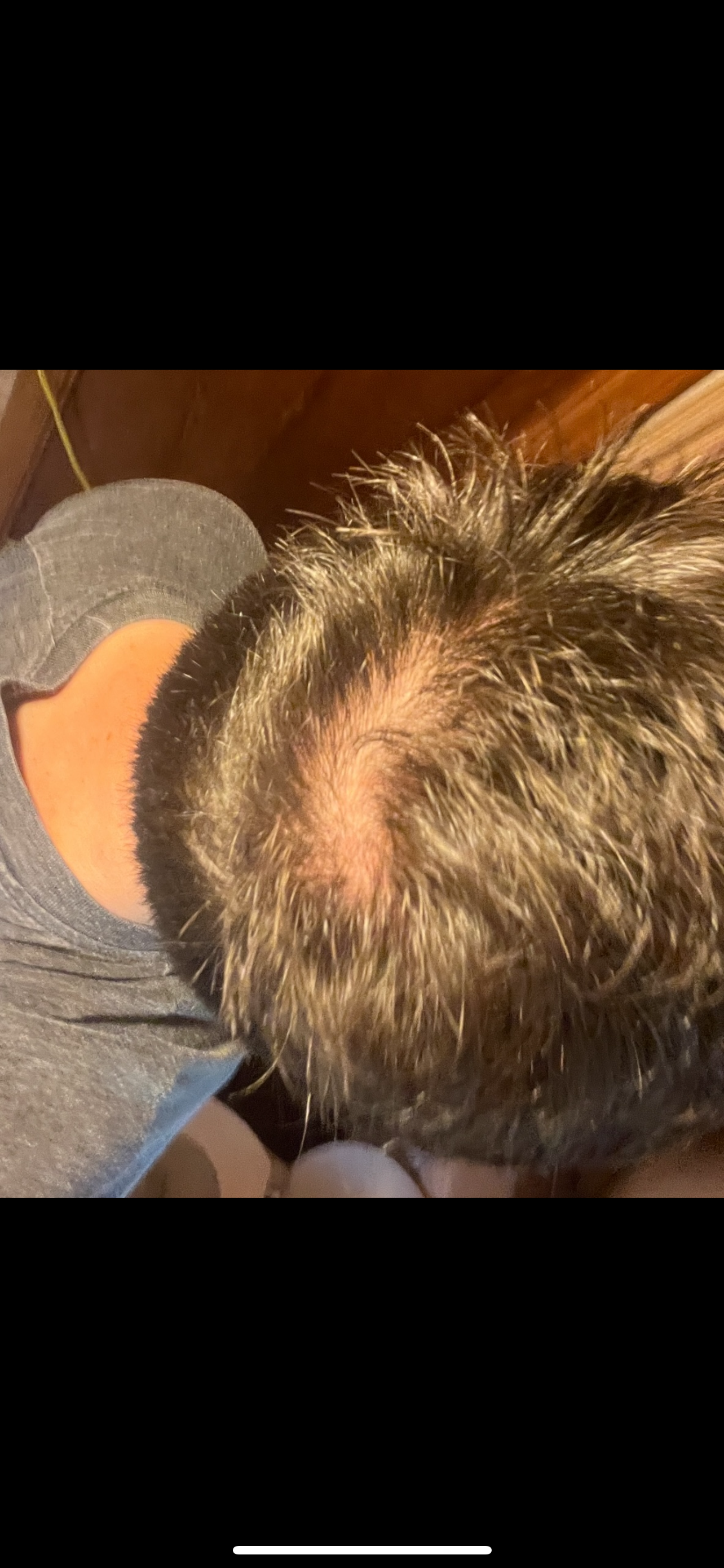 Crown before treatment